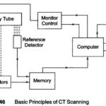 CT Scan Working Principle